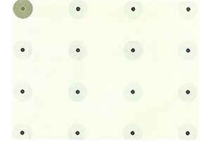 하이테크놀로지 보조기기 - 안구마우스
안구마우스는 하이테크놀로지 장애인 보조기기로서 눈동자의 움직임 및 깜빡임으로 조작하는 대체 마우스다. 일반적으로 안구마우스는 본체에 카메라와 적외선 센서가 달려있고 컴퓨터에 USB로 연결한다. 
눈동자의 움직임을 카메라와 적외선 센서가 인식하게 되면 마우스 커서가 움직이고, 눈 깜빡임으로 아이콘을 클릭할 수 있다. 흔히 사지를 쓰기 어려운 장애인 및 가족들이 컴퓨터 접근이나 의사소통을 위한 방법으로 안구마우스를 떠올린다. 
하지만 사용자와 곁에 있는 보호자들이 조작하기 만만치 않은 기기다. 안구마우스는 사용자의 숙련된 조작을 위해서는 몇 시간, 많게는 수일의 적응 기간이 필요하다. 그리고 그 기간 동안 기기 사용법을 충분히 숙지하고 훈련할 수 있는 전문가 혹은 보조인이 필요하다.